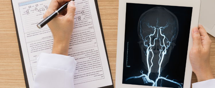 <strong/>Cerebrovascular diseases - STROKE