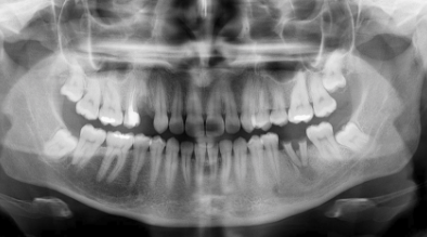 Rectangulo-8588 Rectangulo-8588