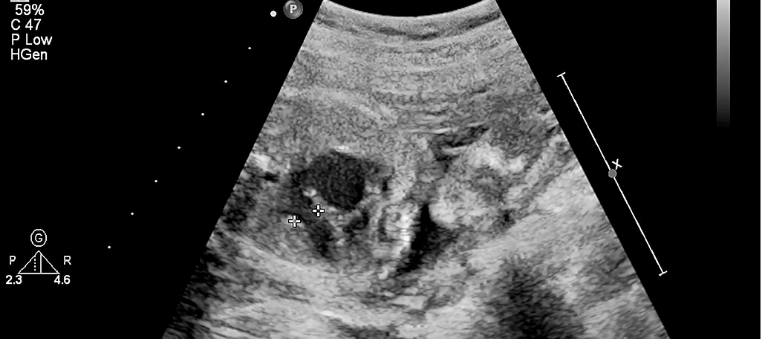 Ecocardiografia fetal Ecocardiografia fetal