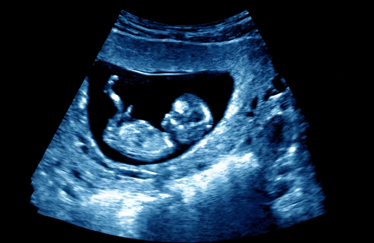 Ultrasonido realizado ante una sospecha de embarazo de alto riesgo, que forma parte de los estudios en esta etapa.