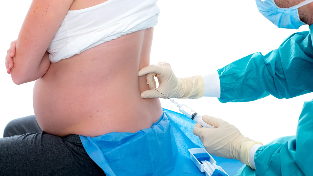 Mujer a punto de recibir una inyección epidural por parte de su médico, para continuar con la labor de parto.