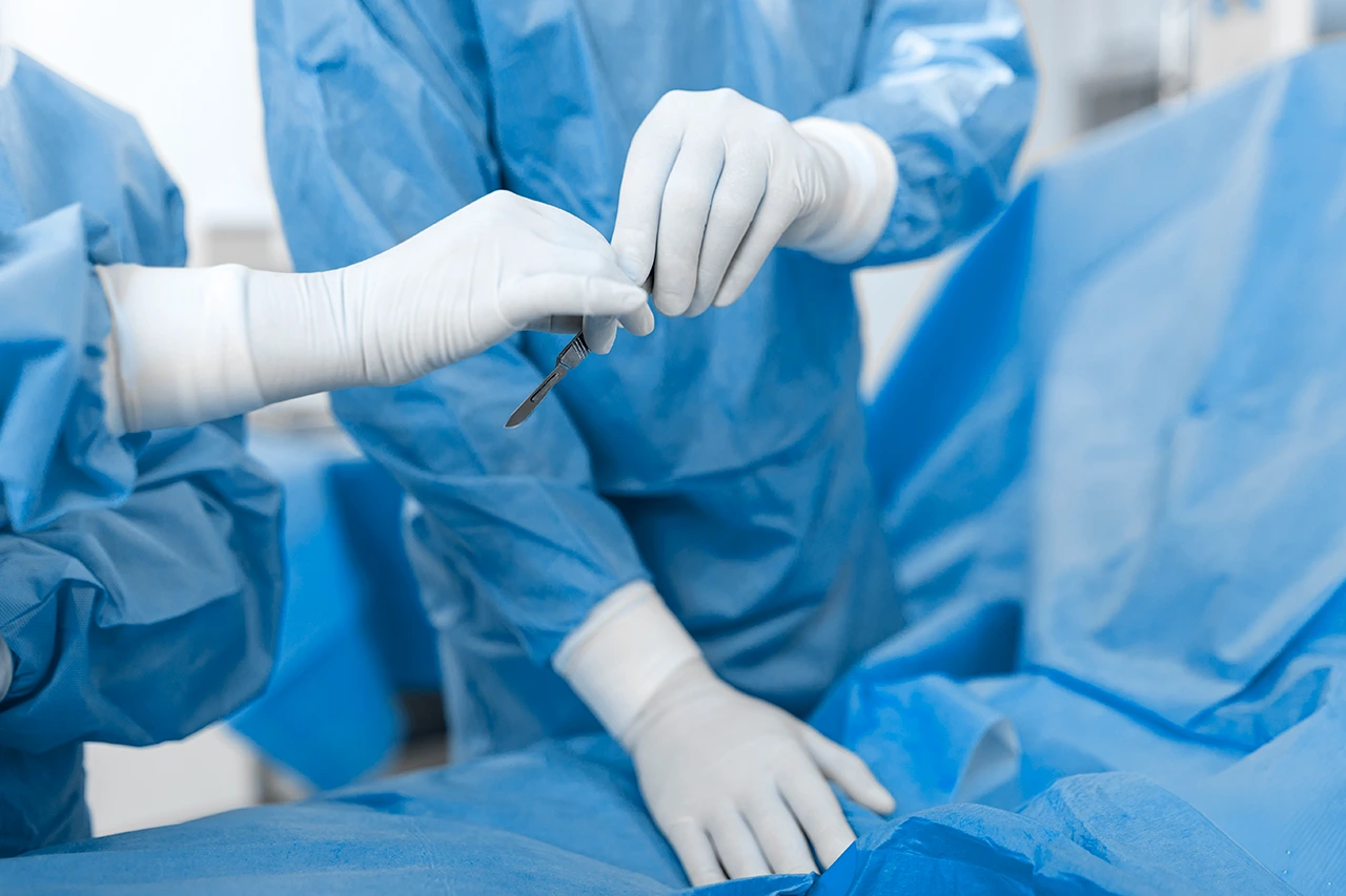 Foto de un médico pasando un bisturí a otro médico, una de las diferencias entre la laparoscopia vs abierta.